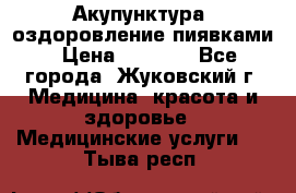 Акупунктура, оздоровление пиявками › Цена ­ 3 000 - Все города, Жуковский г. Медицина, красота и здоровье » Медицинские услуги   . Тыва респ.